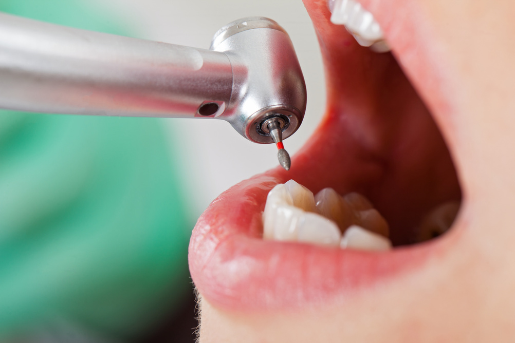 Dental treatment close up